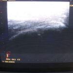 aloka-ultraschallgeraet-ssd-5500-prosound
