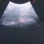 aloka-ultraschallgeraet-ssd-5500-prosound