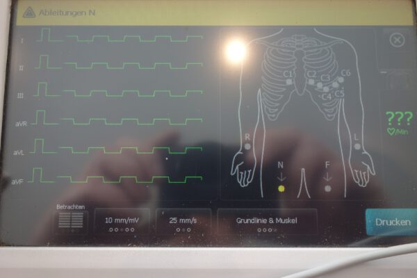 Welch Allyn CP150 EKG Akkubetrieb + Netzbetrieb inkl. Patientenkabel – Bild 4