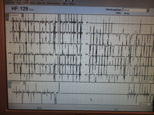 Schiller Cardio-PC Mit AT-104 PC EKG & Spirometer SP-250 – Bild 9