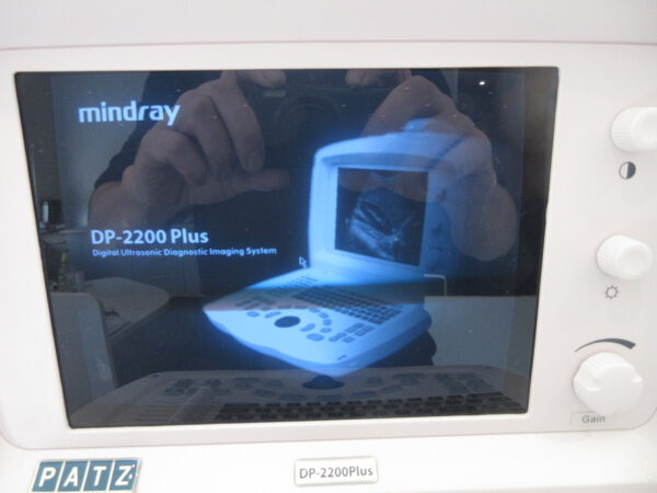 Mindray DP-2200 Plus tragbares Ultraschallgerät portable Ultrasound – Bild 9