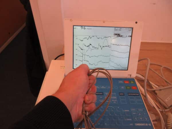 Schiller Cardiovit AT-10 12 Kanal-EKG mit Spirometer SP-150 – Bild 2