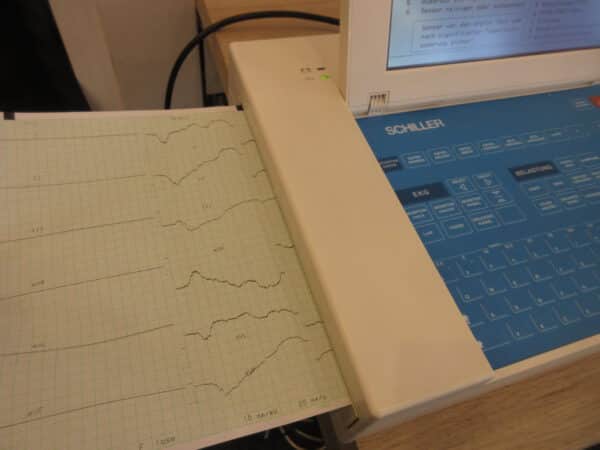 Schiller Cardiovit AT-10 12 Kanal-EKG mit Spirometer SP-150 – Bild 5