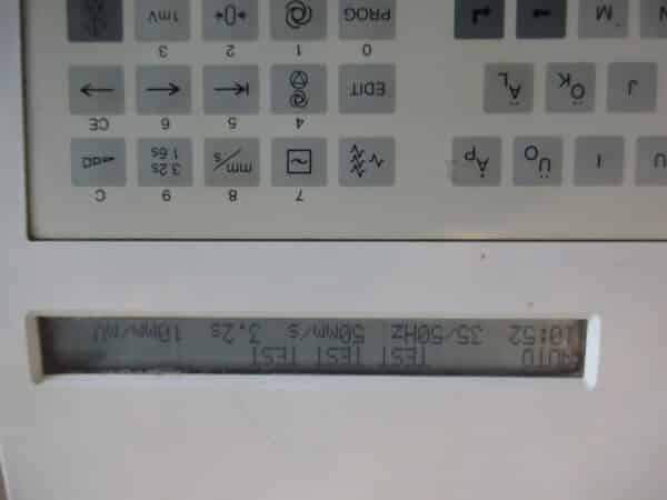 Siemens Cardiostat 31S 3-Kanal EKG – Bild 3