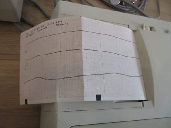 Siemens Cardiostat 31S 3-Kanal EKG – Bild 5