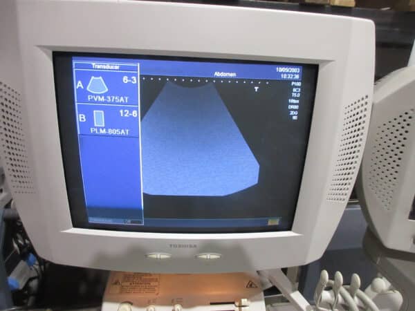 Toshiba Nemio SSA 550 Ultraschallgerät mit 2 Sonden mehrfach – Bild 5