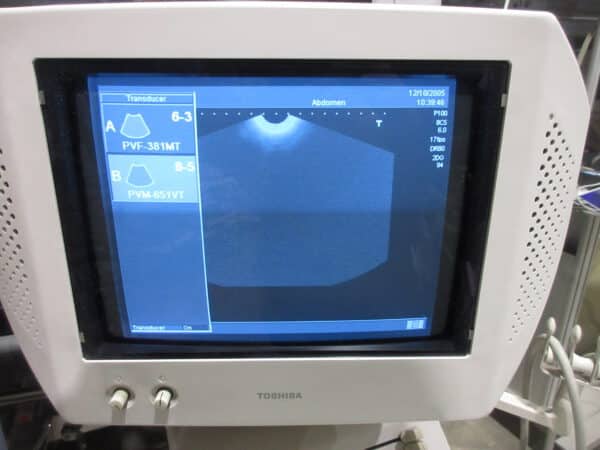 Toshiba Nemio SSA 550 Ultraschallgerät mit 2 Sonden mehrfach – Bild 8