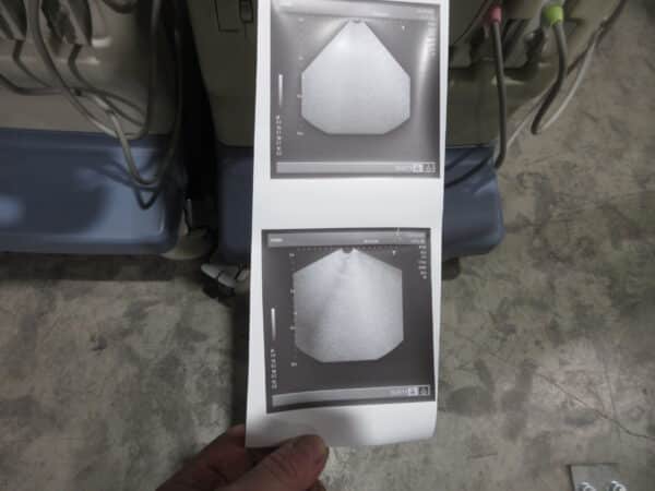 Toshiba Nemio SSA 550 Ultraschallgerät mit 2 Sonden mehrfach – Bild 12