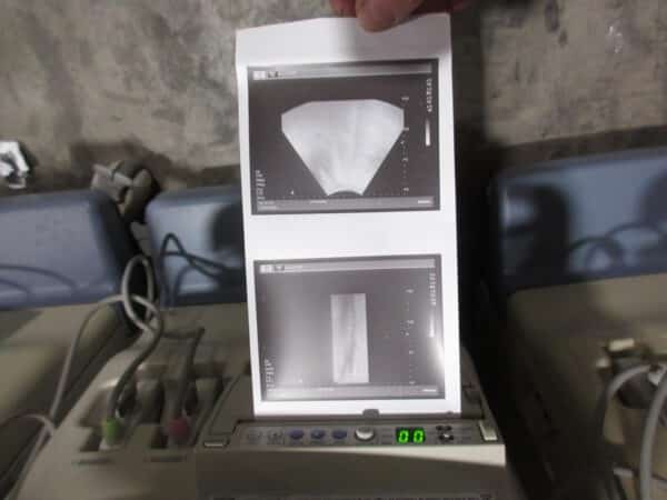 Toshiba Nemio SSA 550 Ultraschallgerät mit 2 Sonden mehrfach – Bild 14