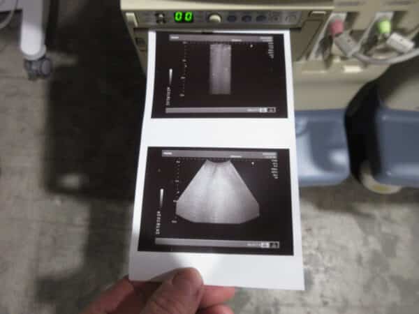 Toshiba Nemio SSA 550 Ultraschallgerät mit 2 Sonden mehrfach – Bild 17