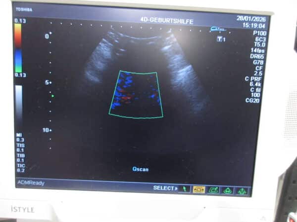 Toshiba Nemio XG Ultraschallgerät mit 3 Sonden – Bild 8