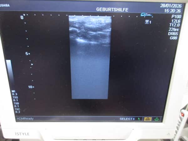 Toshiba Nemio XG Ultraschallgerät mit 3 Sonden – Bild 10