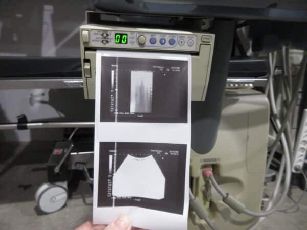 Toshiba famio 8 Ultraschallgerät mit 2 Sonden und Drucker – Bild 6