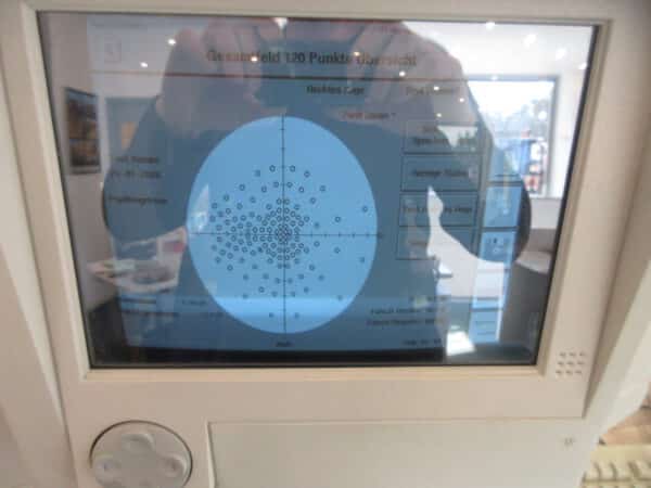 Zeiss Humphrey 720i Field Analyzer II serie i Perimeter – Bild 2