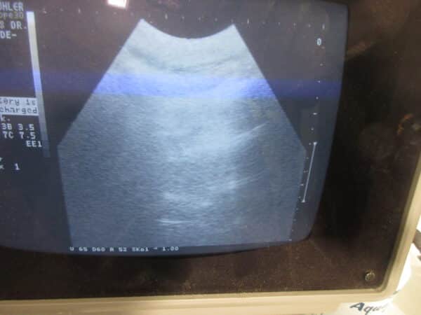 Kranzbühler SonoScope 30 Schallköpfe Abdomen & Linear – Bild 3
