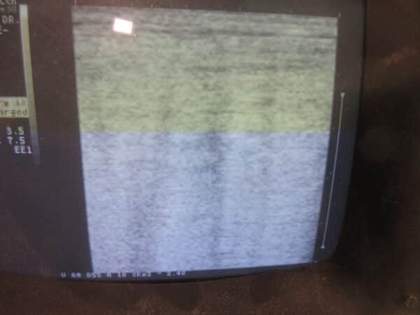 Kranzbühler SonoScope 30 Schallköpfe Abdomen & Linear – Bild 4