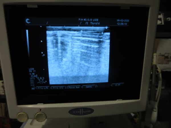 Fukuda Denshi UF-550 XTD Ultraschallgerät mit 2 Sonden und Drucker – Bild 4