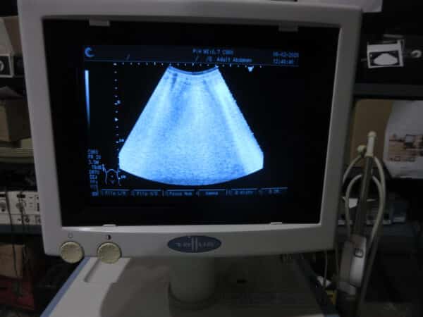 Fukuda Denshi UF-550 XTD Ultraschallgerät mit 2 Sonden und Drucker – Bild 7