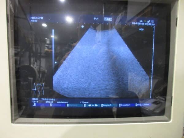 Hitachi EUB-5000 Plus G mit 3 Sonden und Drucker – Bild 7