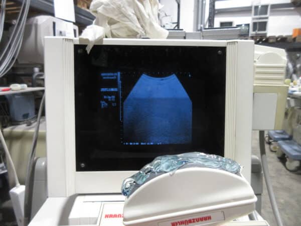 Kranzbühler SonoScope 20 Abdomen Sonde 3.5MHz – Bild 3