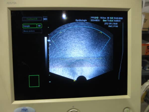 SonoAce 8000 Live Prime mit 3 Sonden und Printer – Bild 5