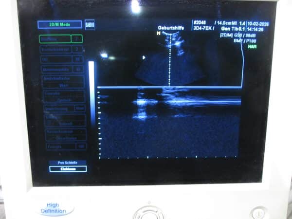 SonoAce 8000 Live Prime mit 3 Sonden und Printer – Bild 7