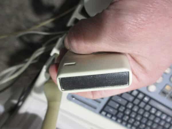 SonoAce 8000 Live Prime mit 3 Sonden und Printer – Bild 8