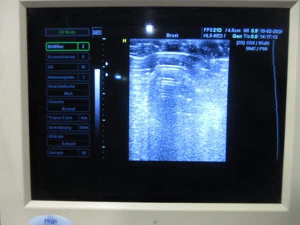 SonoAce 8000 Live Prime mit 3 Sonden und Printer – Bild 9