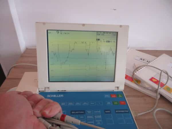 Schiller Cardiovit AT-10 12 Kanal-EKG mit Spirometer SP-150 – Bild 6