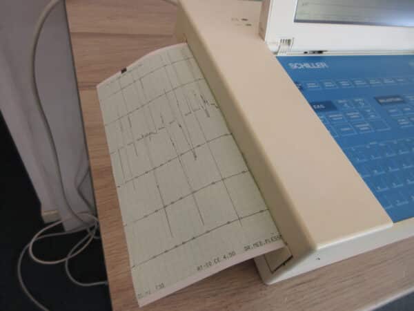 Schiller Cardiovit AT-10 12 Kanal-EKG mit Spirometer SP-150 – Bild 7