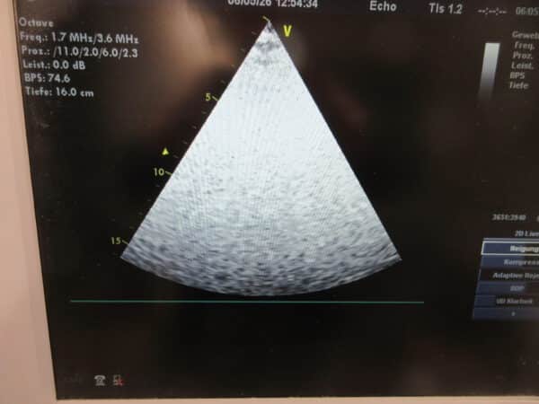 GE Vingmed Vivid 7 Dimension 2 Sonden & Printer – Bild 4