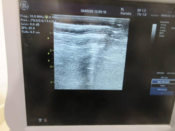 GE Vingmed Vivid 7 Dimension 2 Sonden & Printer – Bild 5