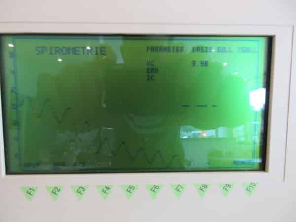 Jäger Flowscreen Spirometer Lufu – Bild 2