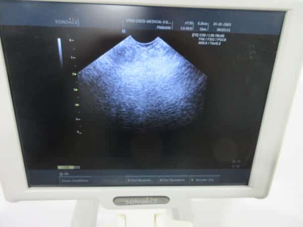 SonoAce X6 Ultraschallgerät mit 3 Sonden und Drucker – Bild 6