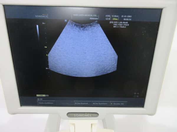 SonoAce X6 Ultraschallgerät mit 3 Sonden und Drucker – Bild 9