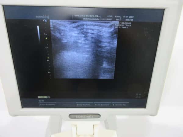 SonoAce X6 Ultraschallgerät mit 3 Sonden und Drucker – Bild 11
