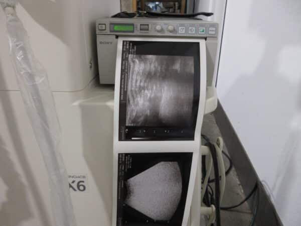 SonoAce X6 Ultraschallgerät mit 3 Sonden und Drucker – Bild 12