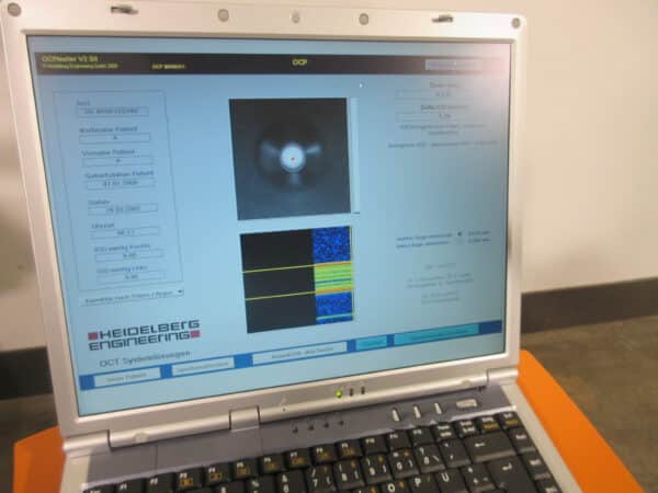 Heidelberg Engineering 4optics OCP Pachymeter Optical Coherence Tomography – Bild 4
