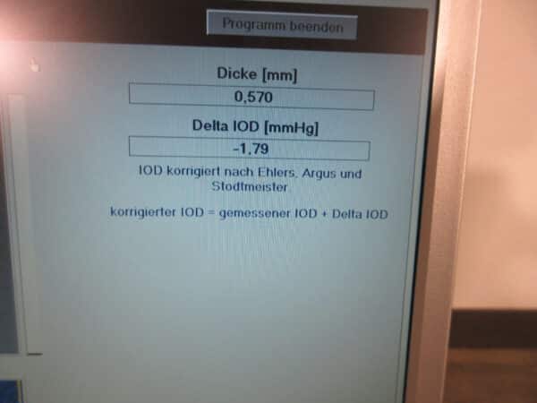 Heidelberg Engineering 4optics OCP Pachymeter Optical Coherence Tomography – Bild 5